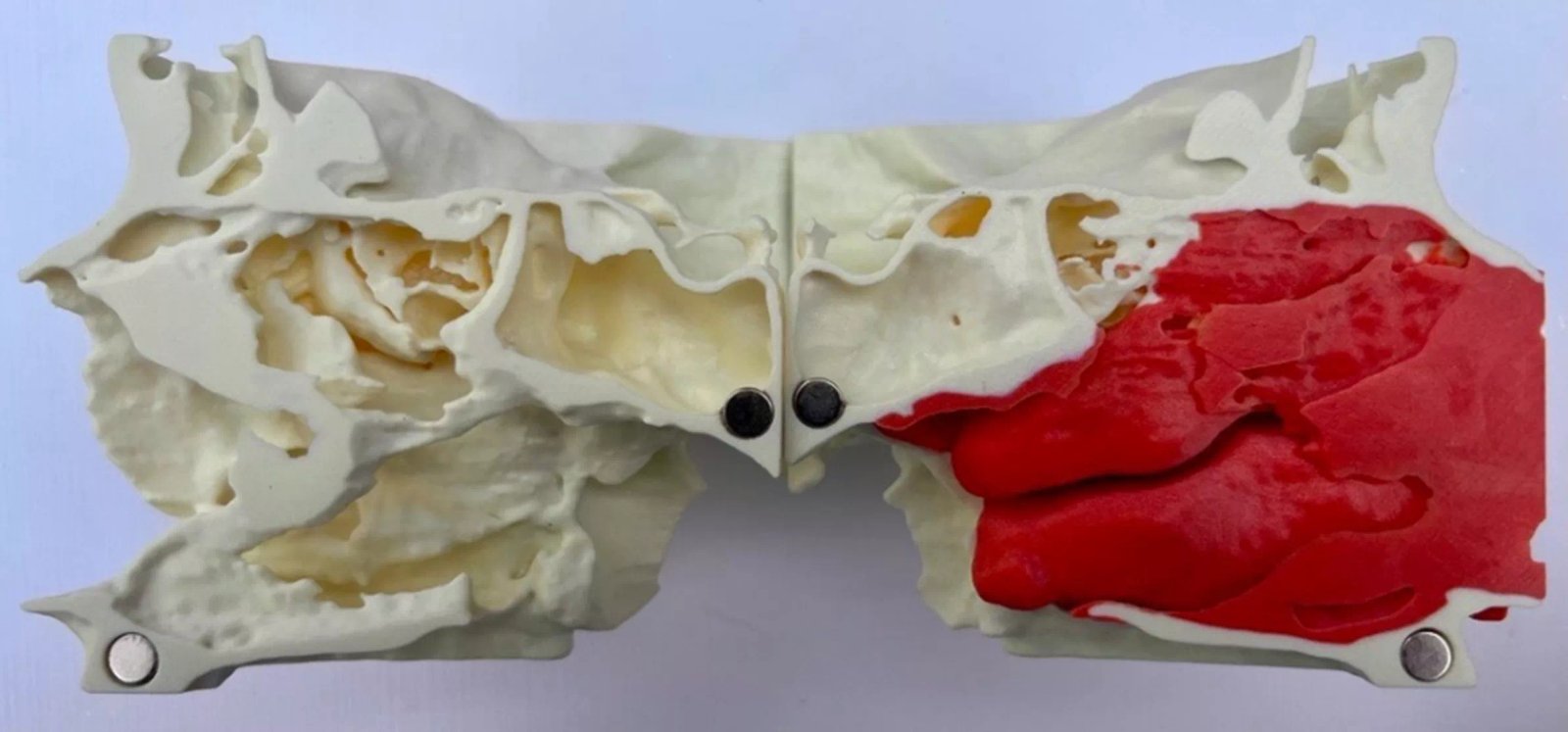 A maxillofacial model split in half to expose the interior